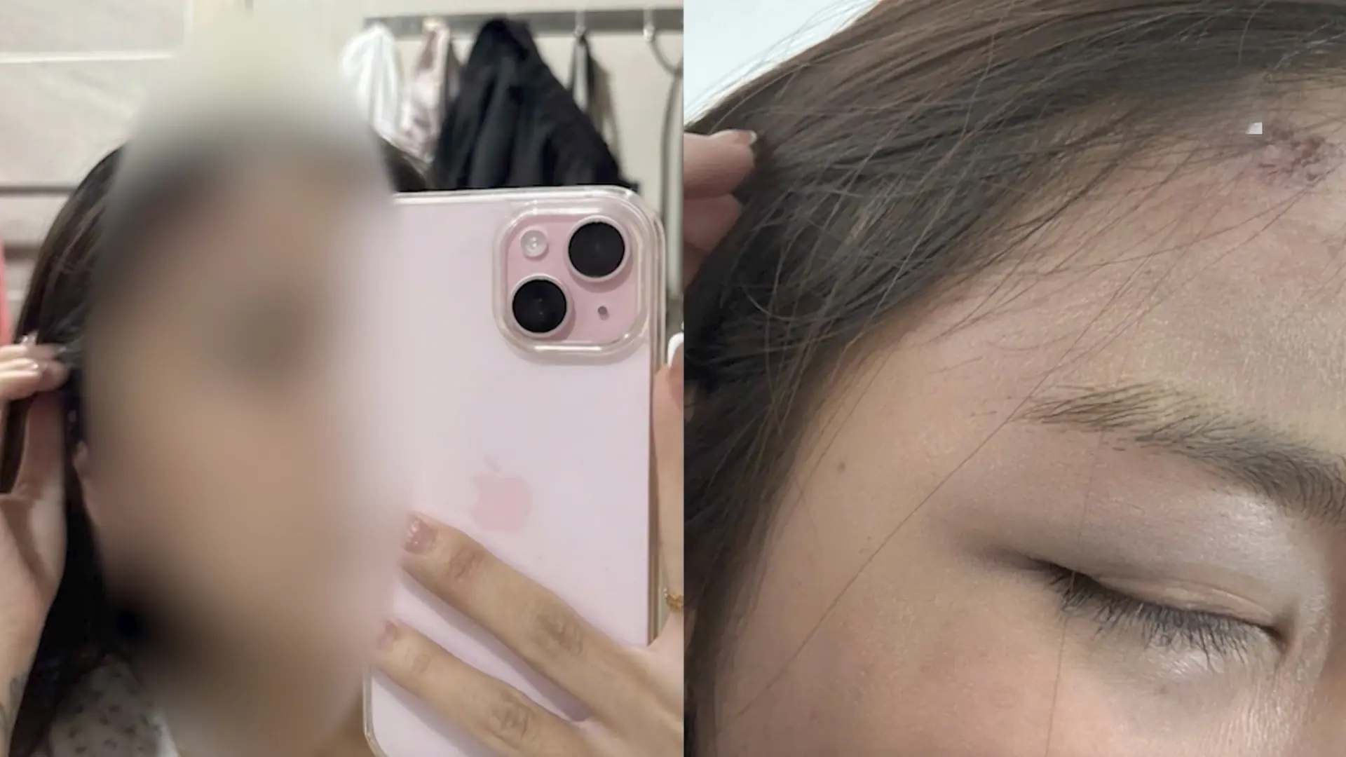 Người phụ nữ tố chồng hành hung dã man tại chung cư